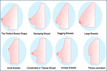 The perception of perfect breast shape vary from culture to culture.
